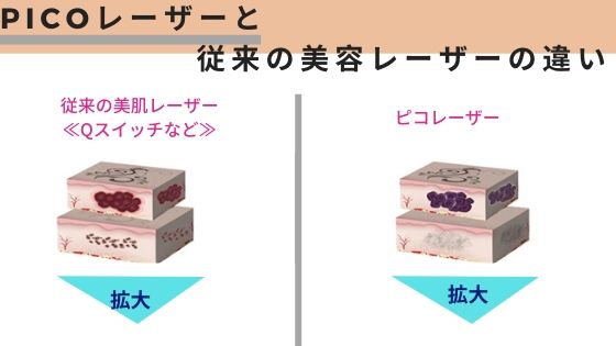 ピコロと従来のシミ取りレーザーの相違点