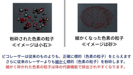 ピコレーザーで粉砕された色素の図
